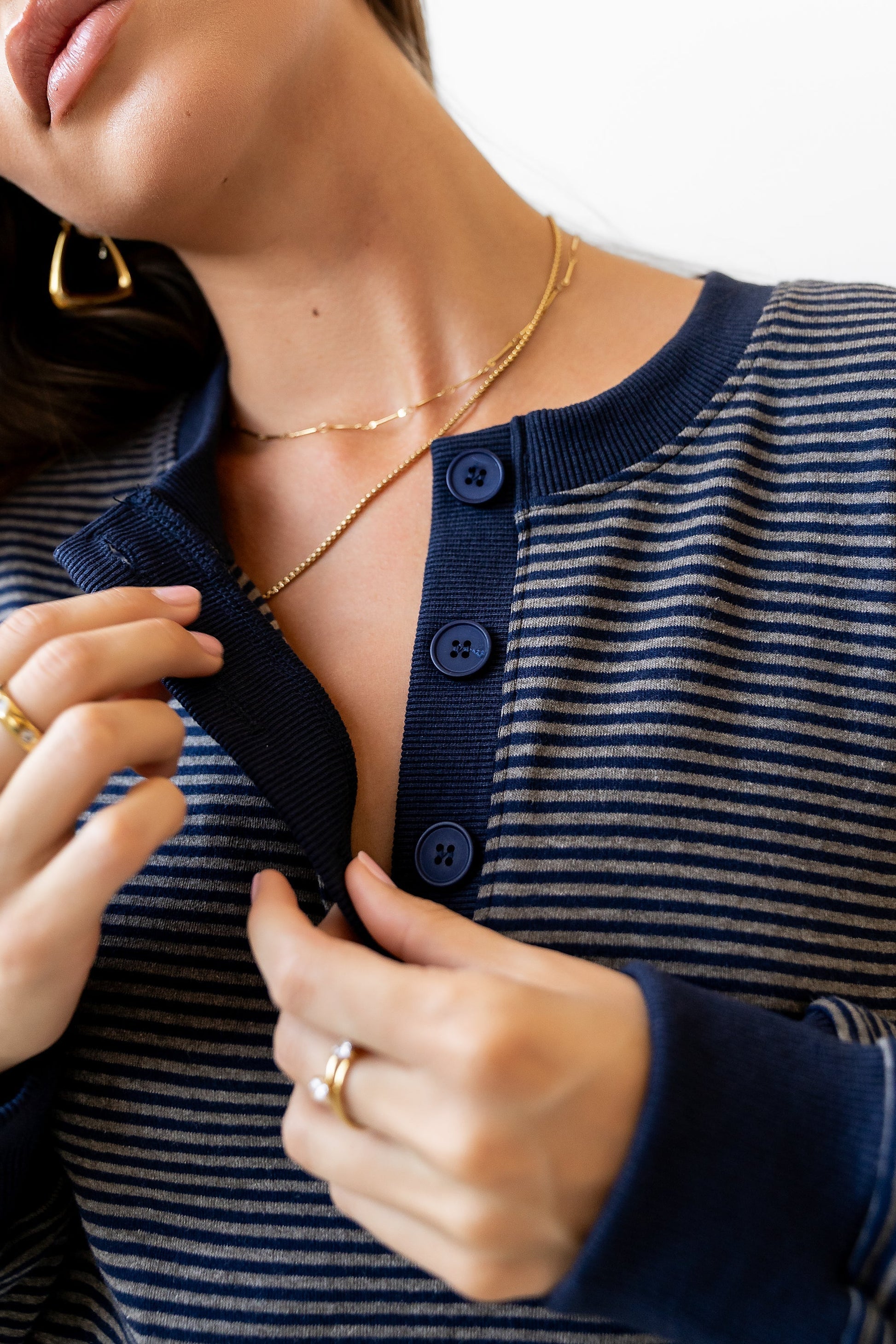 Skye Oversized Striped Top - FINAL SALE